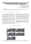 Научная статья на тему 'Перспективный шовный материал - полидиоксанон'