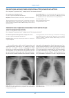 Научная статья на тему 'Pneumothorax and subcutaneous emphysema after pacemaker implantation'