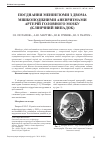 Научная статья на тему 'Поєднання менінгіоми з двома мішкоподібними аневризмами артерій головного мозку (клінічний випадок)'