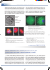Научная статья на тему 'Поиск оптимального "гестационного окна" для ксенотрансплантации эмбриональных тканей'