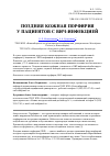 Научная статья на тему 'Поздняя кожная порфирия у пациентов с ВИЧ-инфекцией'