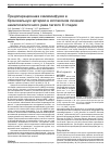 Научная статья на тему 'Предоперационная химиоинфузия в бронхиальную артерию в коплексном лечении немелкоклеточного рака легкого III стадии'