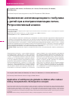 Научная статья на тему 'Применение антитимоцитарного глобулина у детей при аллотрансплантации почек. Ретроспективный анализ'