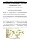 Научная статья на тему 'Применение компактостеотомии в комплексной реабилитации пациентов с зубочелюстными аномалиями и деформациями'