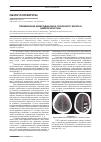 Научная статья на тему 'Применение микродиализа головного мозга в нейрохирургии'
