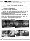 Научная статья на тему 'Применение ортопантомографии в диагностике заболеваний зубочелюстной системы'