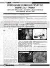 Научная статья на тему 'Применение пьезохирургии и имплантация при критической атрофии альвеолярных отростков челюстей'