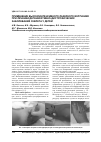 Научная статья на тему 'Применение высокоинтенсивного лазерного излучения при лечении дегенеративно-дистрофических заболеваний скелета у детей'