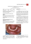 Научная статья на тему 'Проблема анкилоглоссии в детской стоматологической практике'
