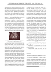 Научная статья на тему 'Прогностическая ценность тонкоигольной аспирационной биопсии и биопсии режущей иглой при подозрении на рак молочной железы'