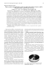 Научная статья на тему 'Протезирование межпозвонковых дисков на уровне поясничного отдела позвоночника с использованием заднебокового доступа'