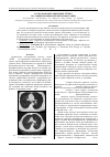 Научная статья на тему 'Распознавание эмфиземы лёгких по данным компьютерной томографии'