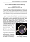 Научная статья на тему 'Разработка информационной технологии оценивания геометрических параметров изображений глазного дна'