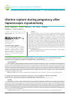 Научная статья на тему 'Разрыв матки во время беременности после лапароскопической миомэктомии'
