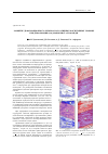 Научная статья на тему 'Развитие деформационного рельефа на различных масштабных уровнях при деформации [110]-монокристаллов меди'