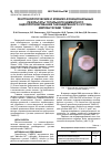 Научная статья на тему 'Рентгенологические и клинико-функциональные результаты тотального цементного эндопротезирования тазобедренного сустава имплантатами "сфен"'