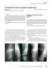 Научная статья на тему 'Ретроградный остеосинтез бедренной и плечевой костей'