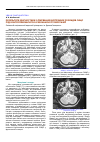 Научная статья на тему 'Результати діагностики і лікування внутрішніх розладів СНЩС під контролем магнітно-резонансної томографії'