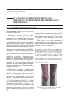 Научная статья на тему 'Результаты лечения гемофилического синовита с применением рифампицинового синовиортеза'