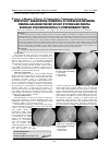 Научная статья на тему 'Sem study: shear bond strength at interface between fiberglass-reinforced splint system and dental surface for periodontally compromised teeth'