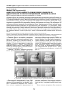 Научная статья на тему 'Симетрія та пропорційність зубних рядів у пацієнтів із одностороннім II класом зубощелепних аномалій за Angle'