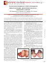 Научная статья на тему 'Склерозирующаяся эпителиоидная фибросаркома молочной железы. Описание случая'