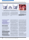 Научная статья на тему 'Случай хирургического лечения пациента с отморожением кистей, осложнившемся развитием костно-суставного панариция'