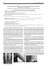 Научная статья на тему 'Случай из практики 3-х клинических форм псориаза'