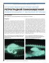 Научная статья на тему 'Случай многоступенчатой ретроградной тонкокишечной инвагинации у зеленой игуаны'
