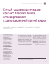 Научная статья на тему 'Случай паранеопластического красного плоского лишая, ассоциированного с аденокарциномой прямой кишки'