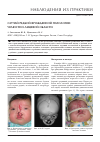 Научная статья на тему 'Случай редкой врожденной патологии челюстно-лицевой области'