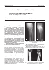 Научная статья на тему 'Случай рецидива эхинококкоза большеберцовой кости'