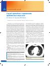 Научная статья на тему 'Случай саркоидоза с поражением придаточных пазух носа'