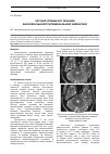 Научная статья на тему 'Случай успешного лечения билатеральной тригеминальной невралгии'