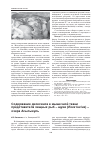 Научная статья на тему 'Содержание диоксинов в мышечной ткани представителя хищных рыб щуки (Esox Iucius) озера Асылыкуль'