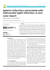 Научная статья на тему 'Splenic infarction associated with Salmonella typhi infection: A rare case report'