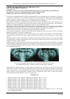Научная статья на тему 'Тактика ортодонтического лечения взрослых при заболеваниях пародонта'