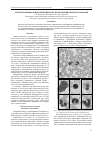 Научная статья на тему 'Технология выделения лейкоцитов на изображениях препаратов крови'