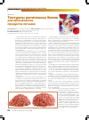 Научная статья на тему 'Текстураты растительных белков для производства продуктов питания'