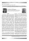 Научная статья на тему 'The incidence of secondary hyperparathyroidism against the background of vitamin d deficiency in patients with endocrine disorders'