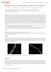 Научная статья на тему 'The role of sip1 in the spine density of neocortical neurons'