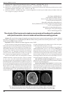 Научная статья на тему 'The study of the improved complex neurosurgical treatment in patients with posttraumatic chronic subdural hematomas and hygromas'