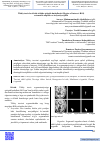 Научная статья на тему 'Tibbiy tasvirlar ichida alohida qiziqish hududlarini (Region of interest–ROI) avtomatik aniqlash va izolyatsiya qilish'