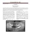 Научная статья на тему 'Травмы в стоматологии'