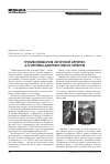 Научная статья на тему 'Тромбоэмболия легочной артерии: алгоритмы диагностики и лечения'