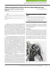 Научная статья на тему 'Тройнично-кардиальный рефлекс в хирургии травм средней зоны лица'