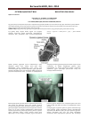 Научная статья на тему 'Туа ұршық шығудың рентгенологиялық сипаты'