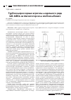 Научная статья на тему 'Турбокомпрессорные агрегаты модельного ряда ш2-мбка на Магнитогорском хлебокомбинате'