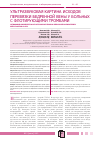 Научная статья на тему 'Ультразвуковая картина исходов перевязки бедренной вены у больных с флотирующими тромбами'