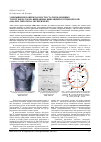 Научная статья на тему 'Уменьшение повреждаемости статоров мощных турбогенераторов, вызванных вибрацией в торцевой зоне (анализ, гипотезы, эксперимент)'